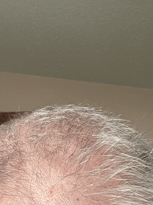 Growth Challenge before photo