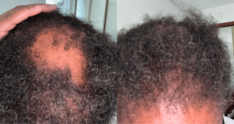 Length retention in 8 weeks