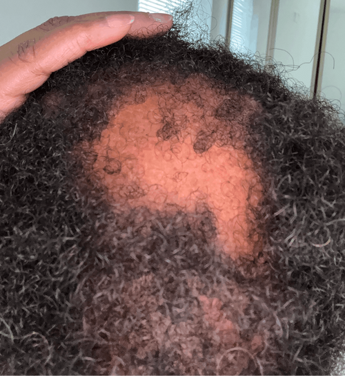 Growth Challenge before photo